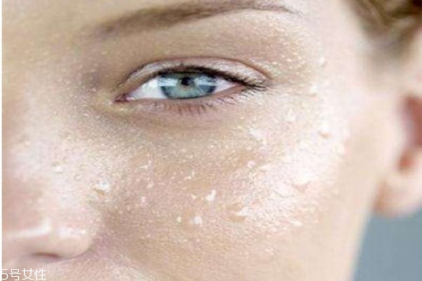 怎么避免皮肤出油,如何改善皮肤出油问题