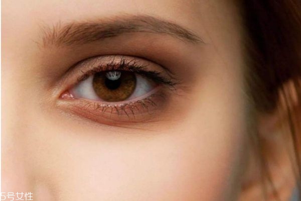 眼纹出现的原因,眼睛有褶皱是怎么回事
