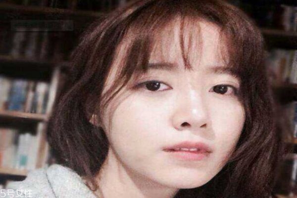 哪种去痘印的方法好,有什么方法去痘印