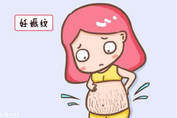 如何有效去除妊娠纹,怎样除去妊娠纹 如何有效去除妊娠纹,怎样除去妊娠纹