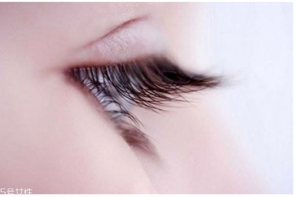 眼睫毛稀少是怎么回事,眼睫毛很少是什么原因