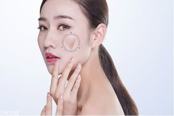 如何快速淡化色素沉着,怎么让色素沉着变淡