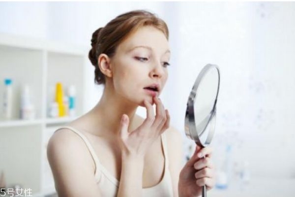 下巴长痘痘怎么回事,下巴长痘 便秘