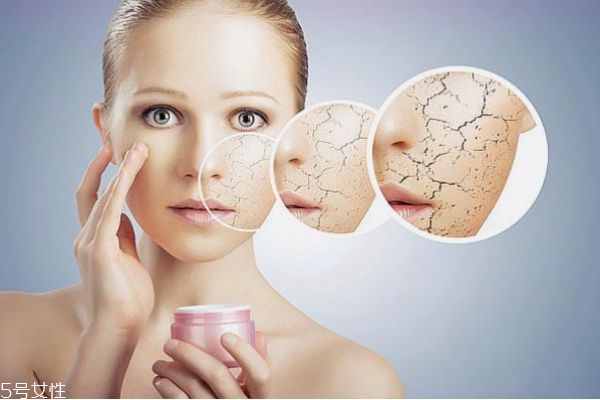 干性皮肤的护理方法,干性皮肤如何保养和护理