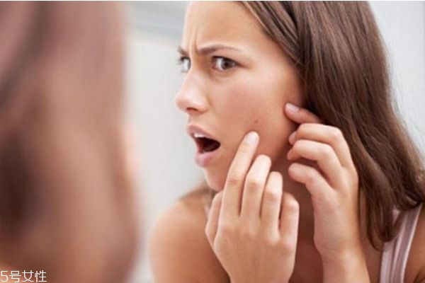 干皮长痘痘是怎么回事,皮肤干燥起皮长痘是什么原因