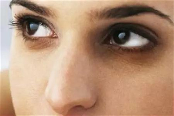 用热毛巾敷眼睛,热毛巾敷眼的正确顺序