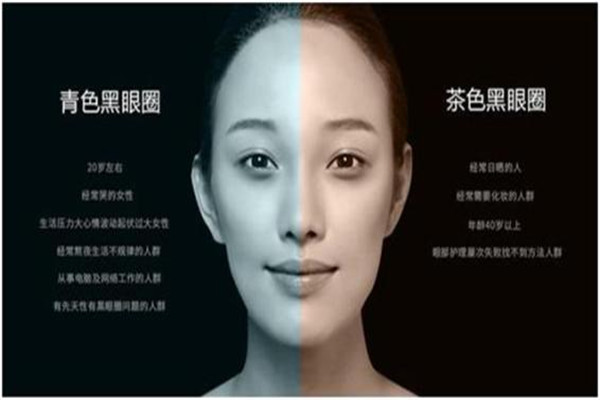 吃什么可以改善黑眼圈和眼袋,吃什么对黑眼圈和黑眼袋好