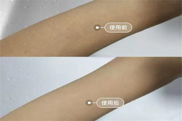 蜜蜡脱毛方法,蜜蜡脱毛方法视频 蜜蜡脱毛方法,蜜蜡脱毛方法视频