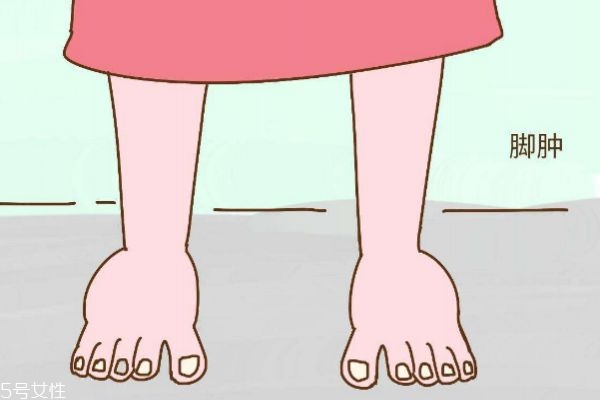 水肿是咋回事,水肿的意思