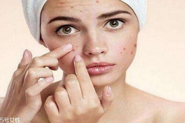 痘痘肌适合用什么洗面奶,痘痘肌肤适合用什么牌子的洗面奶