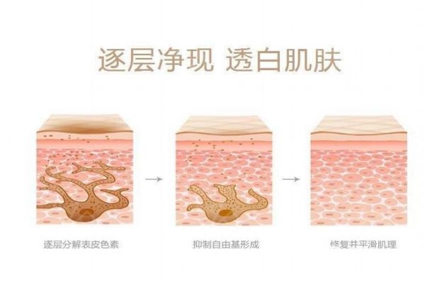 彩光嫩肤能维持多久,彩光嫩肤多久做一次