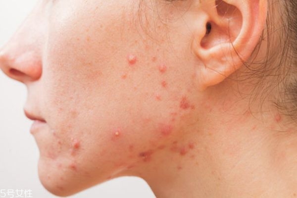 芙清凝胶效果好吗,芙清凝胶有什么功效