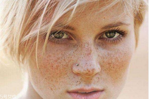 活性斑怎么去除,活性斑怎么彻底根除