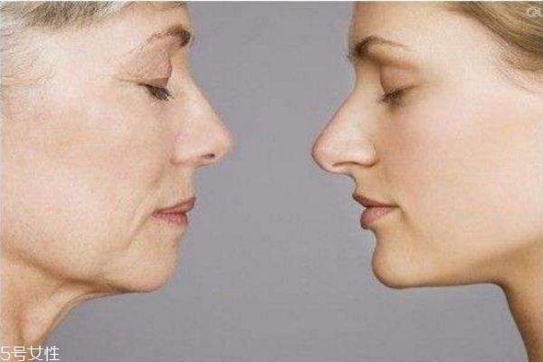 皮肤松弛下垂有什么办法可以改善,皮肤松弛怎么改善