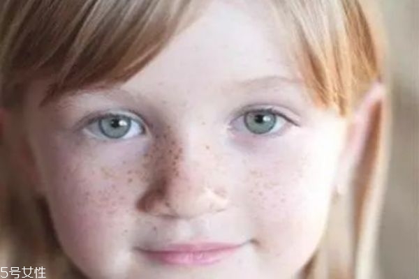 斑的形成原因,斑是如何产生的