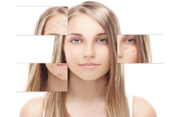 烟酰胺使用禁忌,烟酰胺的禁忌