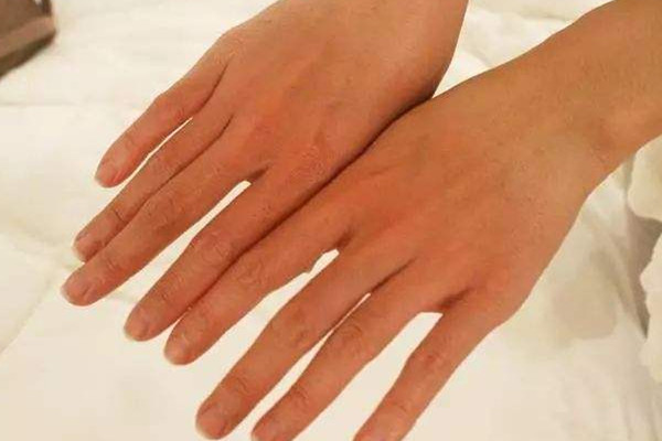 夏天戴帽子能防晒吗,戴帽子可以防晒吗 夏天戴帽子能防晒吗,戴帽子可以防晒吗