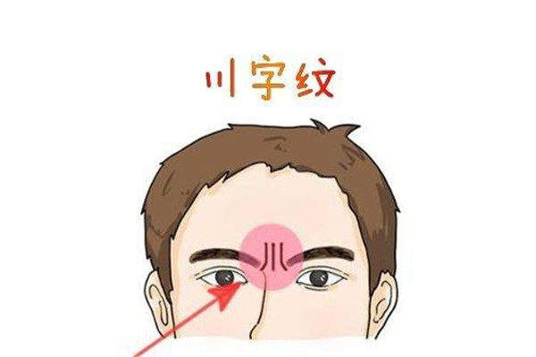 川字纹吃什么可以淡化,祛川字纹最好的方法 川字纹吃什么可以淡化,祛川字纹最好的方法
