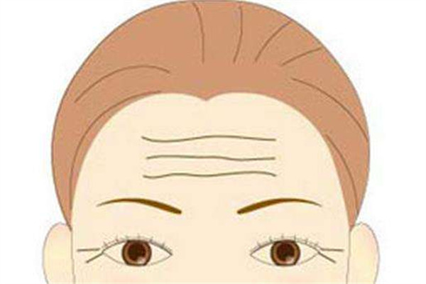 抬头纹是怎么形成的怎么避免,抬头纹是怎么来的 抬头纹是怎么形成的怎么避免,抬头纹是怎么来的