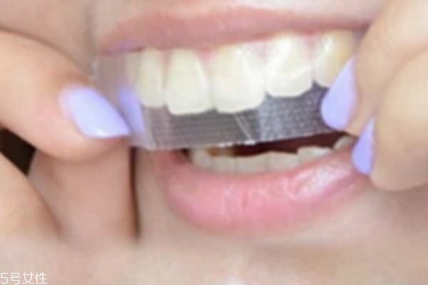 牙贴怎么使用教程,最好的牙贴面是哪个品牌