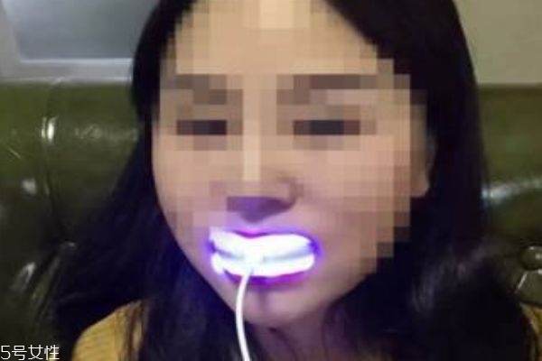 美牙仪可以用吗,美牙仪到底有没有用