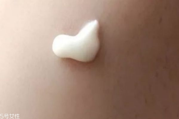 长脂肪粒怎么消除,长脂肪粒怎么才能去掉