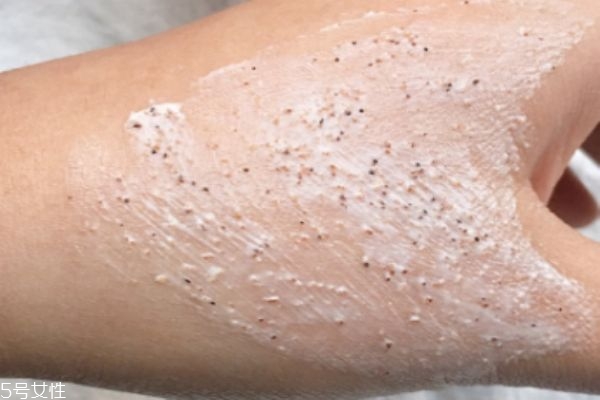 磨砂膏真的可以去鸡皮吗,磨砂膏去鸡皮越来越多