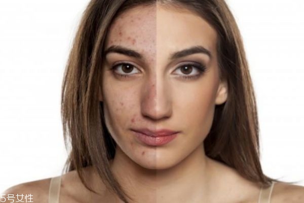 精华液什么时候用最好,什么时候涂精华 精华液什么时候用最好,什么时候涂精华