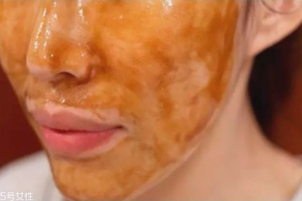 用了撕拉面膜后用什么,用完撕拉面膜应该用什么面膜