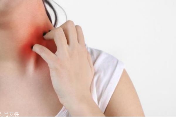 秋天皮肤干燥瘙痒怎么办,秋季皮肤干燥痒怎么治疗