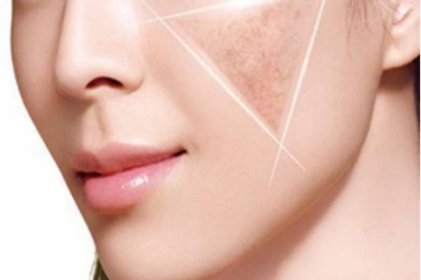 美白的成分有哪些,效果分别怎样,什么成分美白