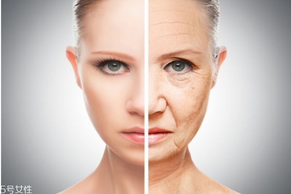 熬夜长斑了能去掉吗,熬夜长斑能不能消退 熬夜长斑了能去掉吗,熬夜长斑能不能消退