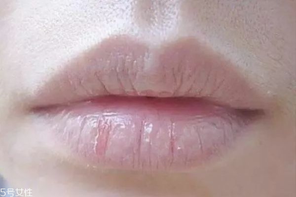 嘴唇干怎么保养,嘴唇怎么保养才不干