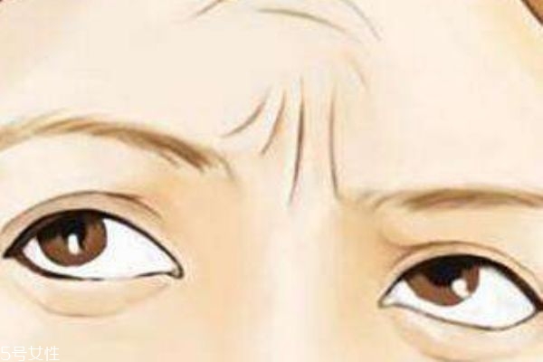 川字纹是什么原因引起的,川字纹是什么样子的