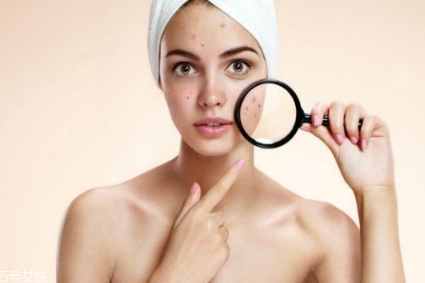 脸上长脓包痘痘怎么调理,脸上长脓包型痘痘怎么调理