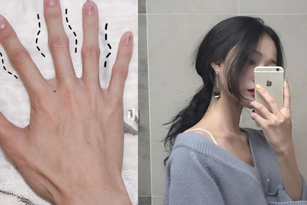 手指关节变粗是什么原因造成的,手指的关节变粗什么原因