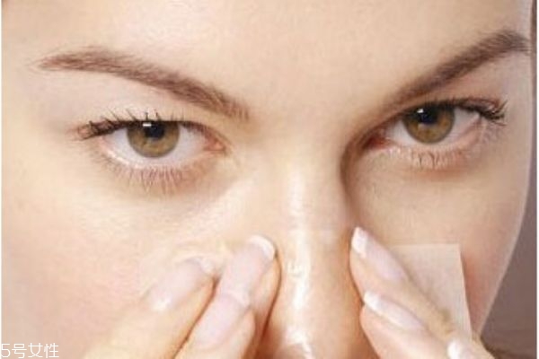 有鼻头黑头怎么引起的,鼻头长黑头的原因