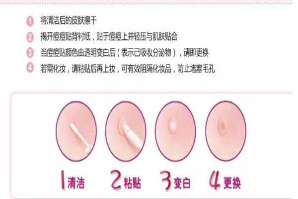 贴痘痘贴要把痘痘弄破吗,贴痘痘贴之前要挤痘吗