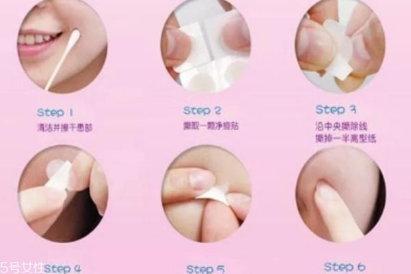 美若康净痘贴怎么样,美若康痘痘贴 美若康净痘贴怎么样,美若康痘痘贴