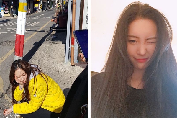 怎样预防脂溢性皮炎,脂溢性皮肤炎怎么治