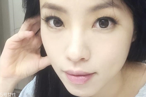 如何改善油痘肌,油痘肌怎么办