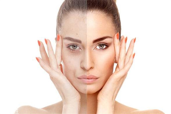 正确祛痘的方法有哪些,日常什么方法可以祛痘