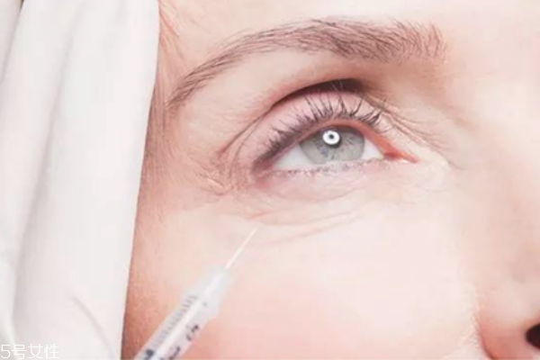 最有效的去鱼尾纹的方法,眼部鱼尾纹怎么去掉