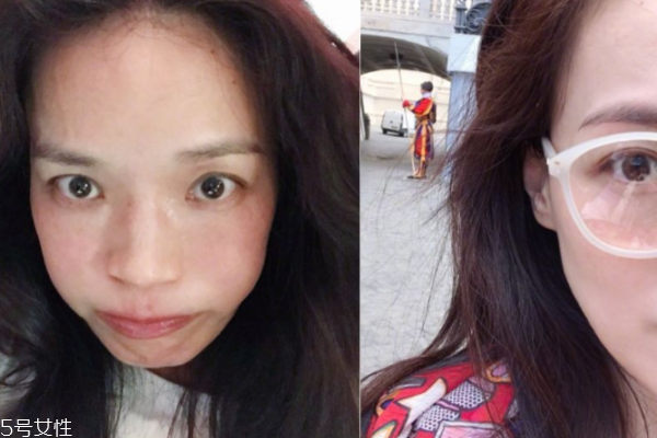 敏感肌怎么鉴别,怎么辨别敏感肌 敏感肌怎么鉴别,怎么辨别敏感肌