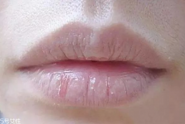 护唇小妙招,天然护唇方法和小妙招