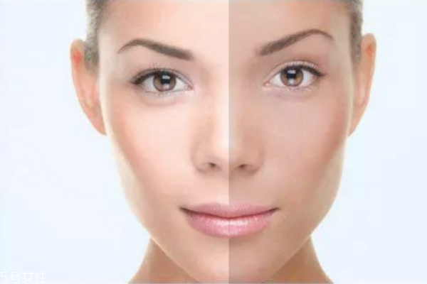 皮肤发黄的原因有哪些,人的皮肤发黄是什么原因 皮肤发黄的原因有哪些,人的皮肤发黄是什么原因