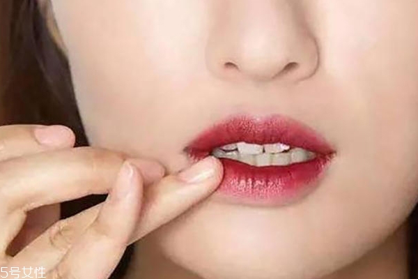 嘴角发黑怎么办?,嘴角怎么会发黑