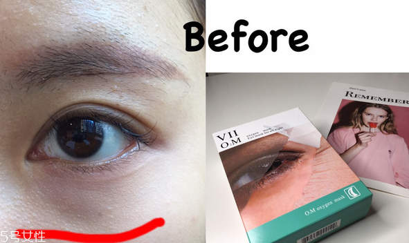 viicode眼膜有用吗,viicode眼膜真有效吗