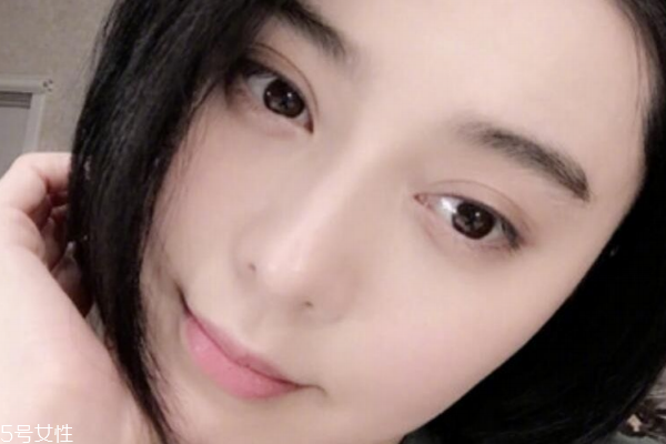 敏感肌红血丝可以打水光针吗,皮肤敏感能打水光针吗