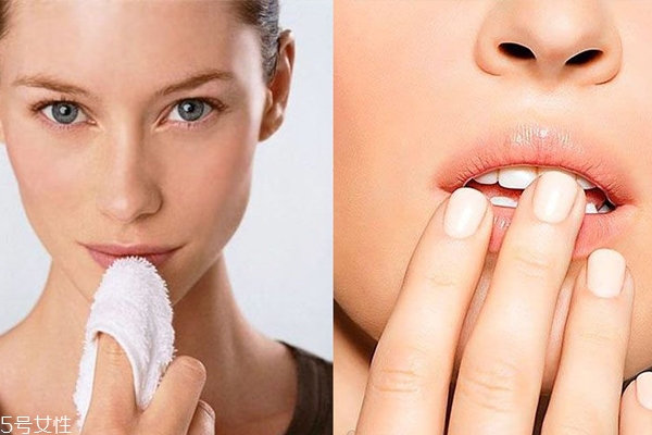 唇膜多久做一次比较好,唇膜多久做一次